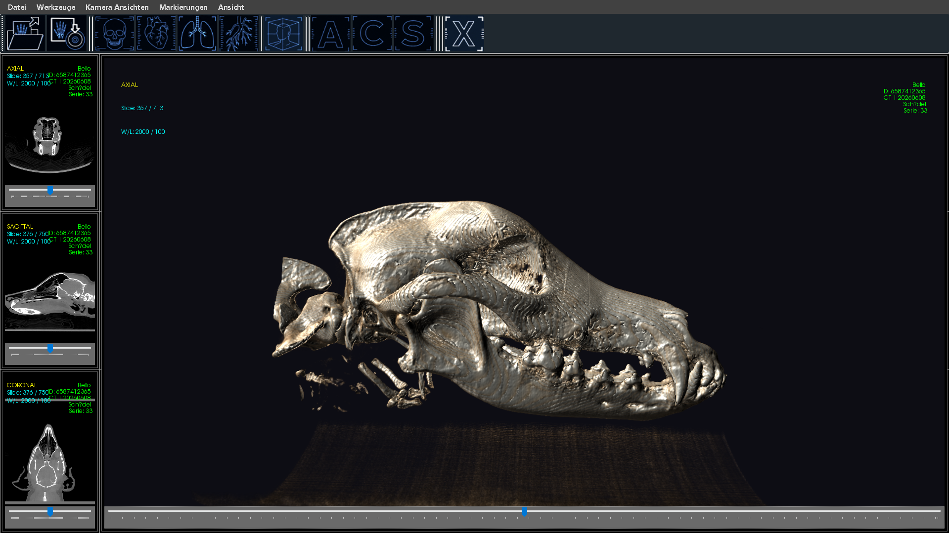 3D Integration